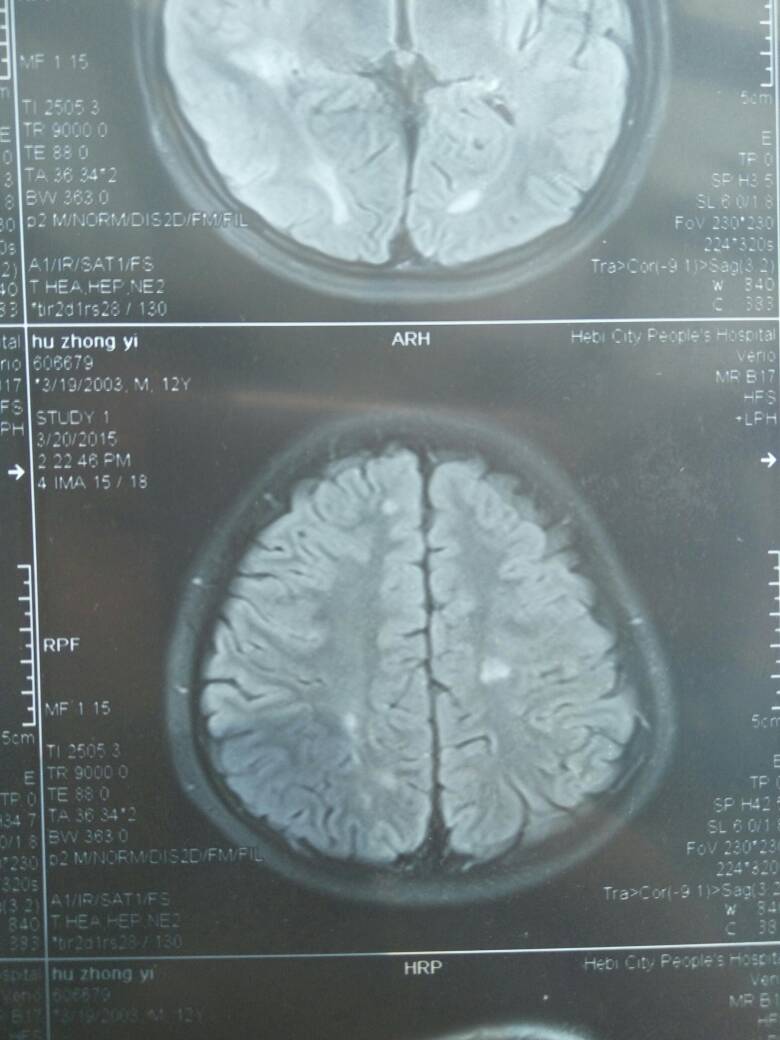 111254dg59u9f2dz5whgfs.jpg