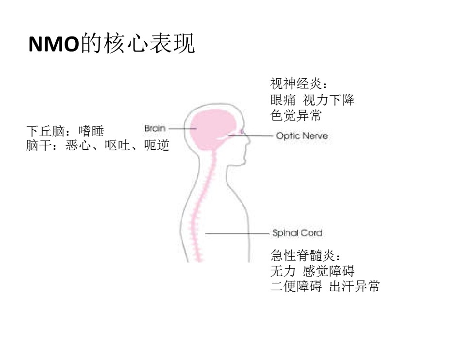 幻灯片14.JPG