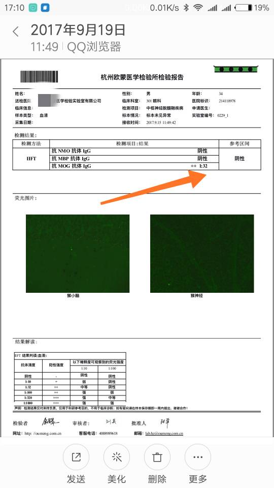 163212xt419jwmos1311bt.jpg