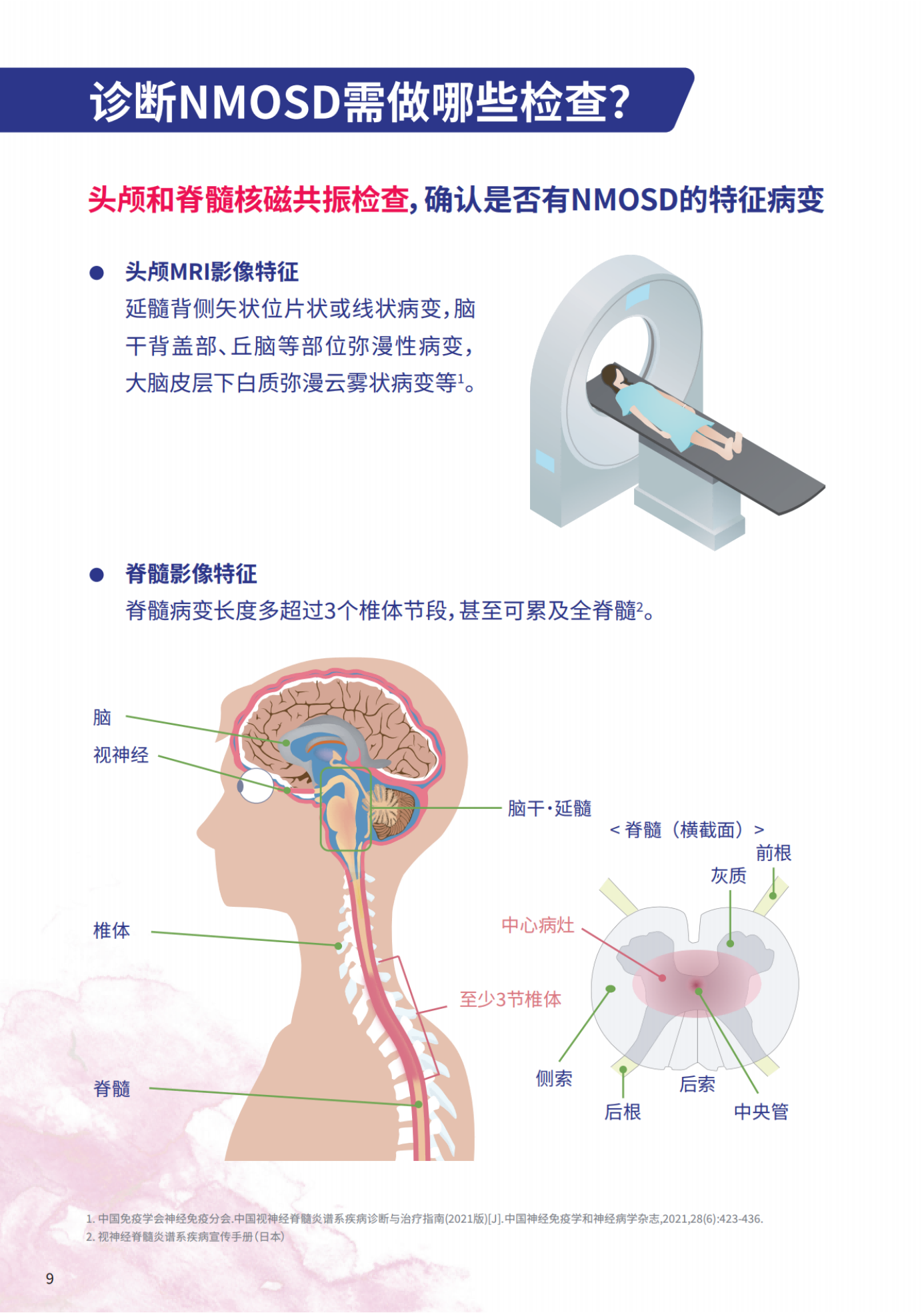 视神经脊髓炎患者知识手册_纯图版_11.png